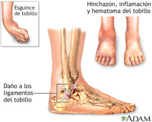 ligamentos-tobillo-esguince-fisioterapia-osteopatía-murcia